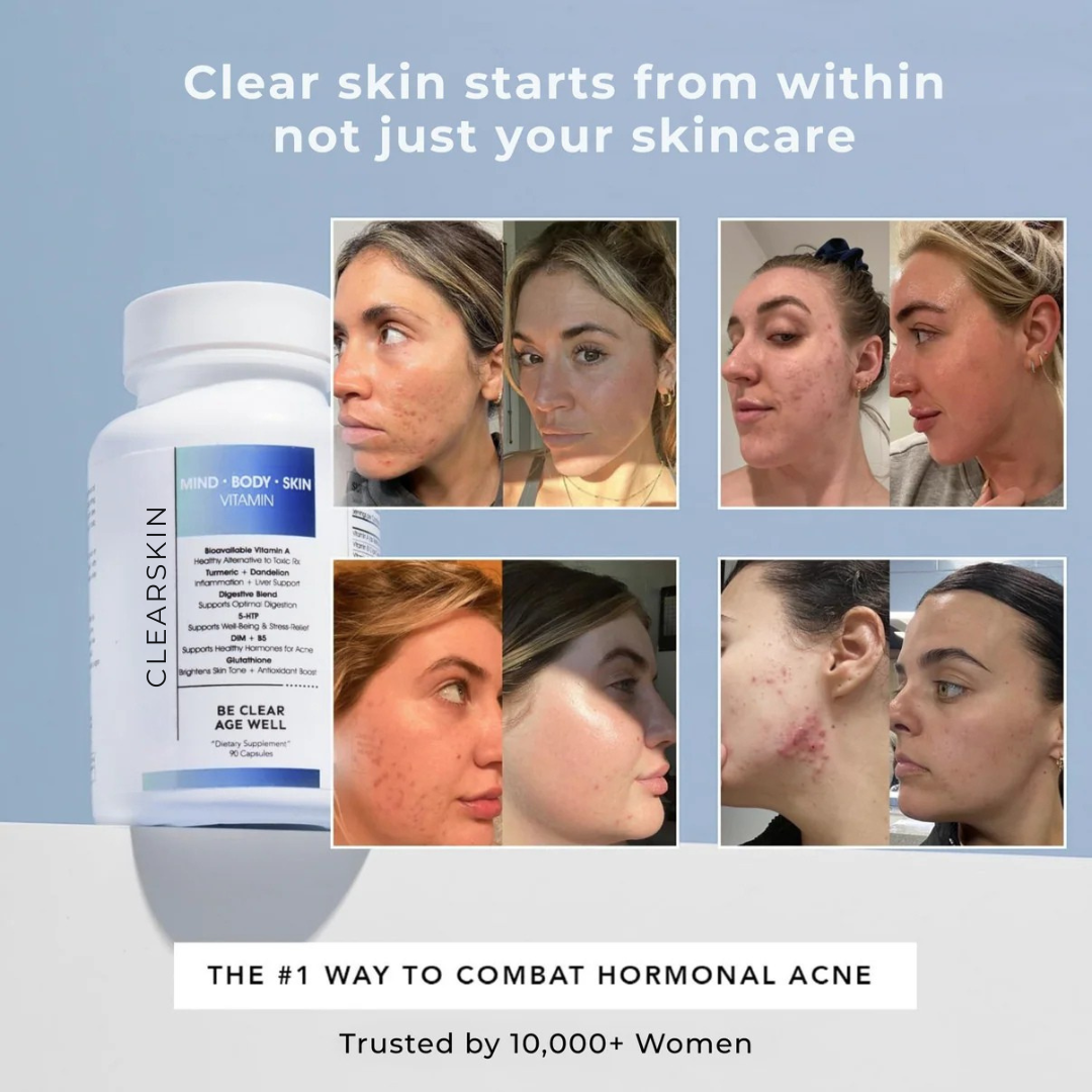 ClearSkin: Hormonal Acne Supplement For Women