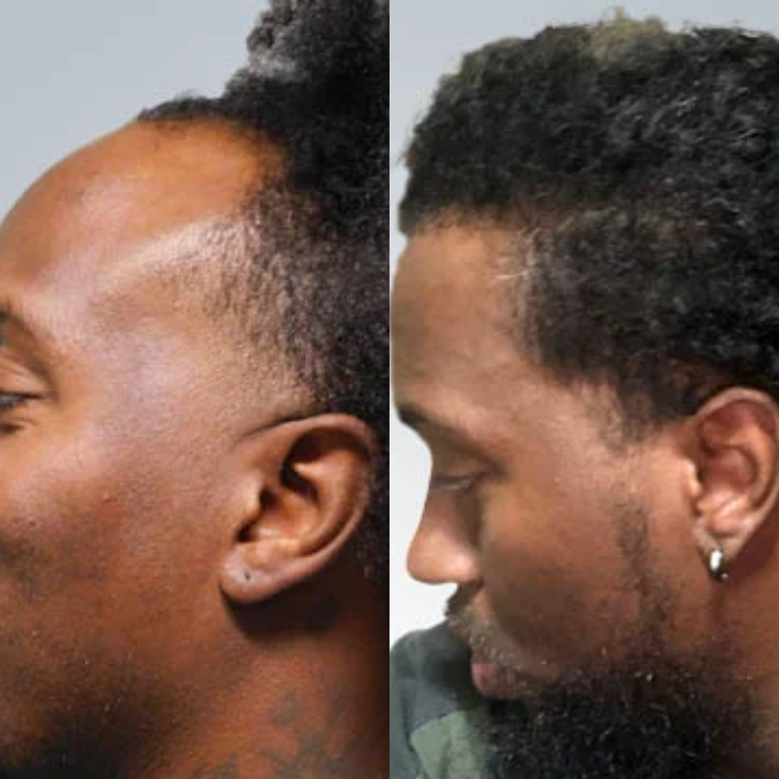 Root Revive Capsules