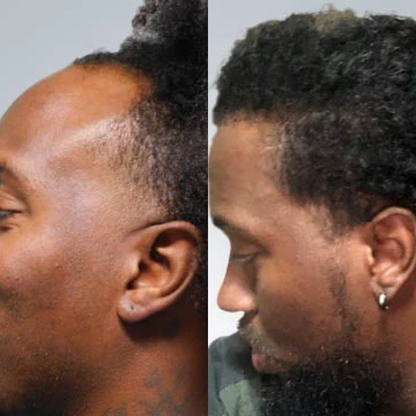 Root Revive Capsules