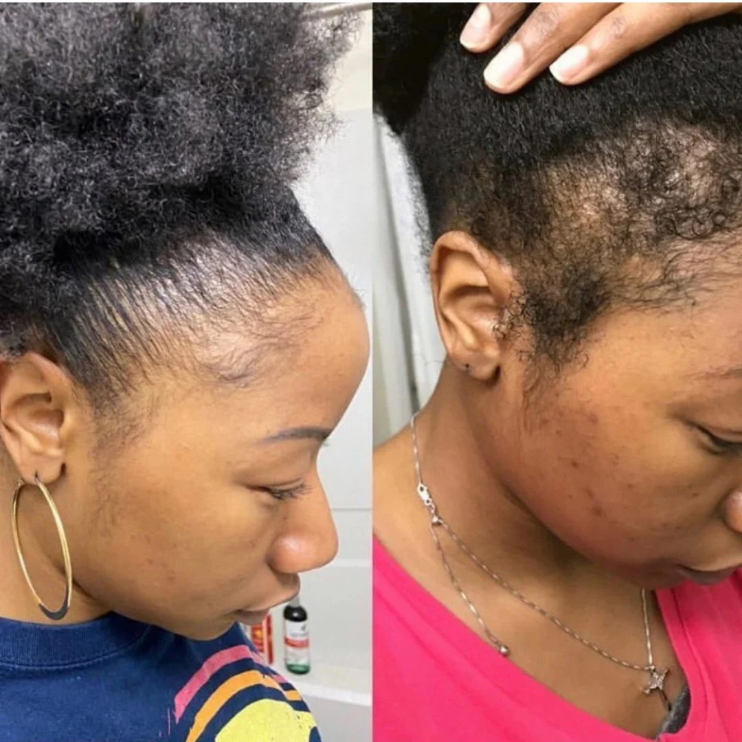 Root Revive Capsules