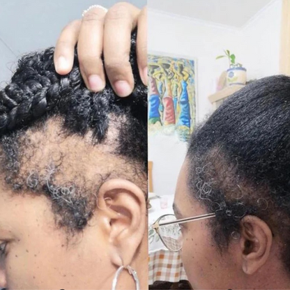 Root Revive Capsules