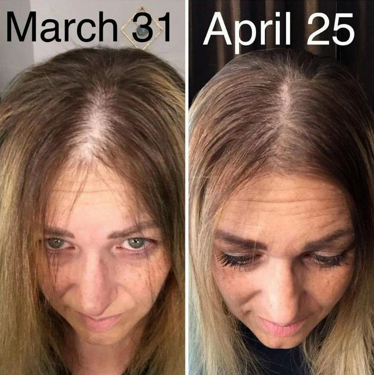 Hair Growth Accelerator - with Lustriva®